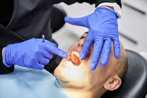 Best Emergency Wisdom Tooth Extraction in Unionville, TN
