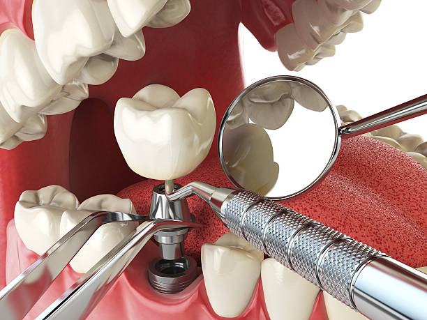 Professional Emergency Dental Service in TN
